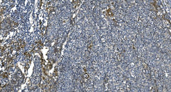 eRF1/ETF1 Mouse Monoclonal Antibody