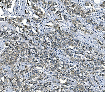 eRF1/ETF1 Mouse Monoclonal Antibody