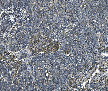 eRF1/ETF1 Mouse Monoclonal Antibody