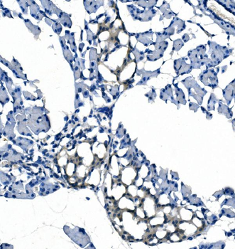 eRF1/ETF1 Mouse Monoclonal Antibody