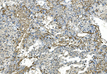 Fibrinogen beta chain/FGB Mouse Monoclonal Antibody