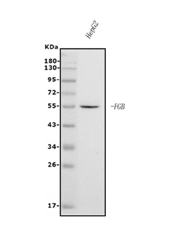 Fibrinogen beta chain/FGB Mouse Monoclonal Antibody