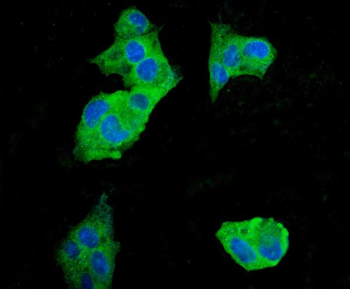 EEF2 Mouse Monoclonal Antibody