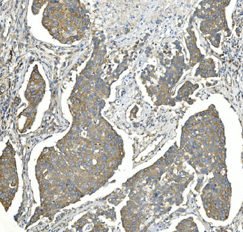 EEF2 Mouse Monoclonal Antibody