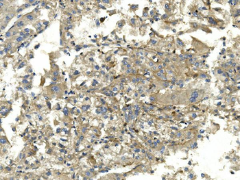EEF2 Mouse Monoclonal Antibody