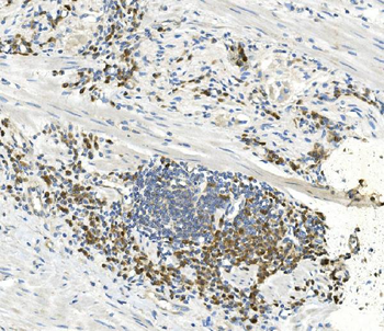 EEF2 Mouse Monoclonal Antibody