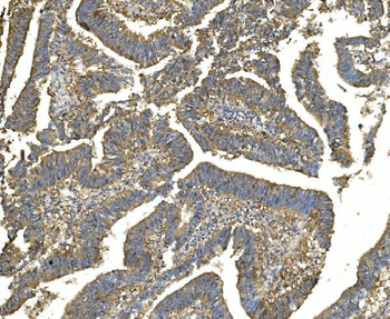 EEF2 Mouse Monoclonal Antibody