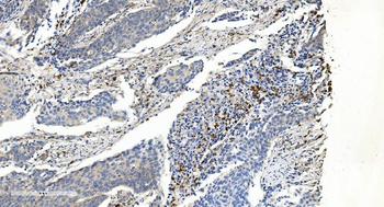APPL/APPL1 Mouse Monoclonal Antibody