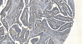 APPL/APPL1 Mouse Monoclonal Antibody