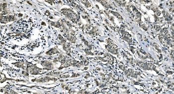 Carbonic Anhydrase I/CA1 Mouse Monoclonal Antibody