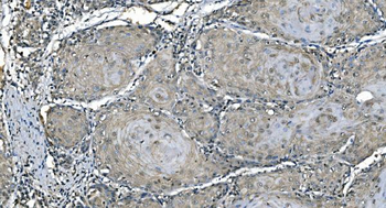 Carbonic Anhydrase I/CA1 Mouse Monoclonal Antibody