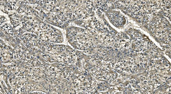 Carbonic Anhydrase I/CA1 Mouse Monoclonal Antibody