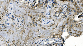 Carbonic Anhydrase I/CA1 Mouse Monoclonal Antibody