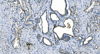 Carbonic Anhydrase I/CA1 Mouse Monoclonal Antibody