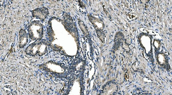 Carbonic Anhydrase I/CA1 Mouse Monoclonal Antibody