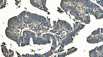 Carbonic Anhydrase I/CA1 Mouse Monoclonal Antibody
