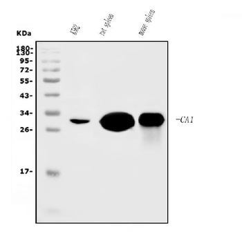 Carbonic Anhydrase I/CA1 Mouse Monoclonal Antibody