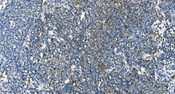 Carbonic Anhydrase I/CA1 Mouse Monoclonal Antibody