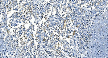 Carbonic Anhydrase I/CA1 Mouse Monoclonal Antibody