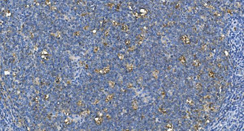 Carbonic Anhydrase I/CA1 Mouse Monoclonal Antibody