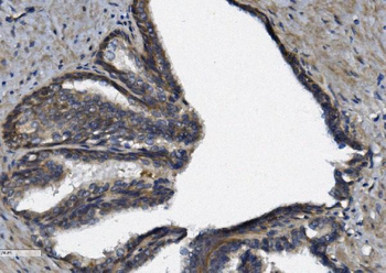 AFAP/AFAP1 Rabbit Polyclonal Antibody