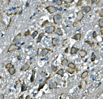 CD97/Adgre5 Rabbit Polyclonal Antibody