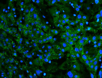 N Cadherin/CDH2 Rabbit Polyclonal Antibody