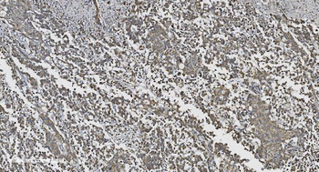 N Cadherin/CDH2 Rabbit Polyclonal Antibody