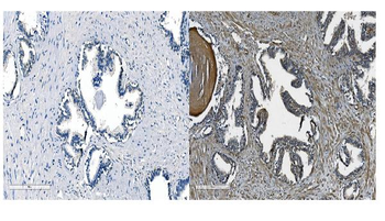 OB Cadherin/CDH11 Rabbit Polyclonal Antibody