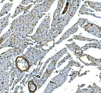 H Cadherin/CDH13 Rabbit Polyclonal Antibody