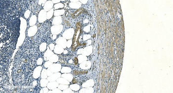 H Cadherin/CDH13 Rabbit Polyclonal Antibody