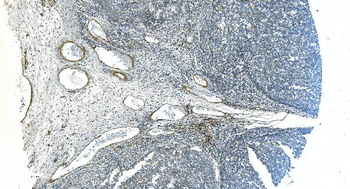 H Cadherin/CDH13 Rabbit Polyclonal Antibody