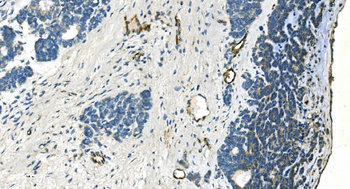 H Cadherin/CDH13 Rabbit Polyclonal Antibody