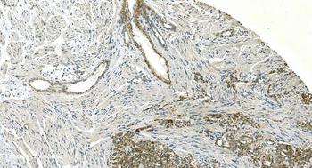H Cadherin/CDH13 Rabbit Polyclonal Antibody