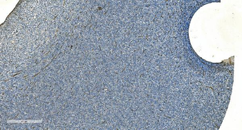 H Cadherin/CDH13 Rabbit Polyclonal Antibody