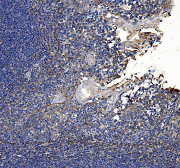 Collagen VII/COL7A1 Rabbit Polyclonal Antibody