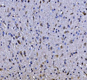EEF2/Elongation factor 2 Rabbit Polyclonal Antibody