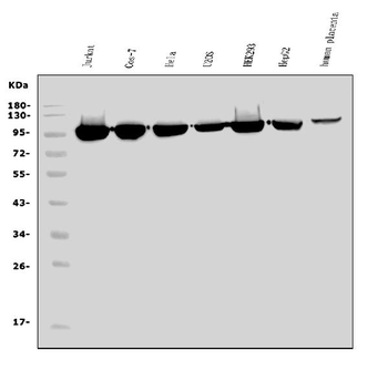 EEF2/Elongation factor 2 Rabbit Polyclonal Antibody