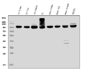 EEF2/Elongation factor 2 Rabbit Polyclonal Antibody