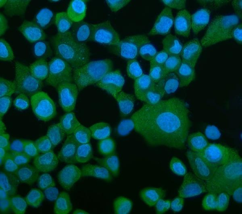 EEF2/Elongation factor 2 Rabbit Polyclonal Antibody