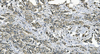 EEF2/Elongation factor 2 Rabbit Polyclonal Antibody