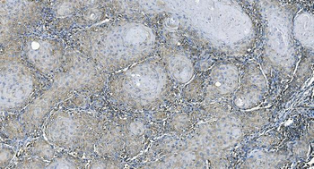 EEF2/Elongation factor 2 Rabbit Polyclonal Antibody