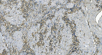 EEF2/Elongation factor 2 Rabbit Polyclonal Antibody