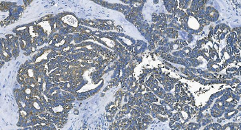 EEF2/Elongation factor 2 Rabbit Polyclonal Antibody