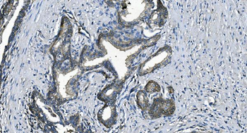 EEF2/Elongation factor 2 Rabbit Polyclonal Antibody