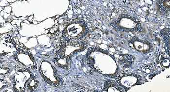 EEF2/Elongation factor 2 Rabbit Polyclonal Antibody