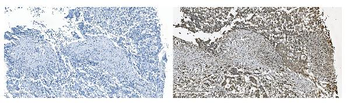 GRSF1 Rabbit Polyclonal Antibody
