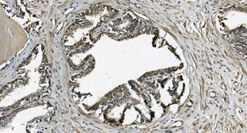 GRSF1 Rabbit Polyclonal Antibody