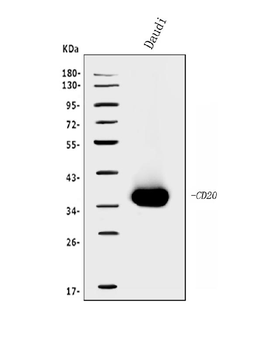 CD20/MS4A1 Antibody