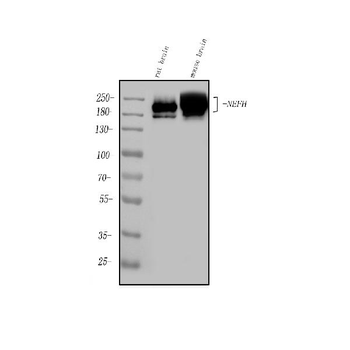 Nefh Rabbit Polyclonal Antibody